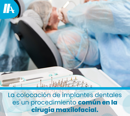 Ciruga Maxilofacial para Colocar Implantes Dentales