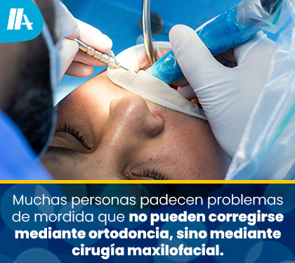 Ciruga Maxilofacial para Corregir Problemas de Mordida u Oclusin