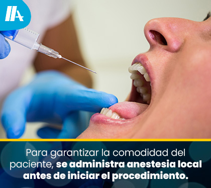 Dentista Coloca Anestesia para Realizar una Endodoncia