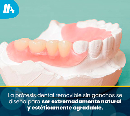 Creacin de la Prtesis Dental Removible Sin Ganchos