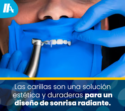 Demtista Realiza Diseo de Sonrisa con Carillas