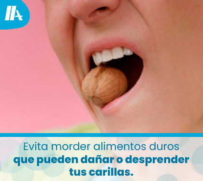 Persona Muerde Nueces con Diseo de Sonrisa con Carillas