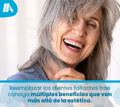 Mujer Adulta Mayor Reemplaza sus Dientes Faltantes con Implantes Dentales